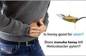 Manuka Honey inhibits Helicobacter pylori